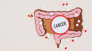 Are Carbohydrates Linked to Colorectal Cancer?