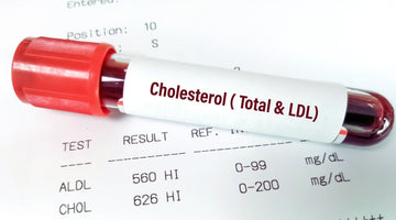 Healthy Living Tips:  Forget High Cholesterol These Three Killers Are Far Worse