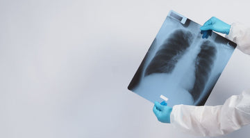Lung Cancer Never Smoked