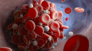 Natural Ways to Avoid the Dangers of Blood Clots