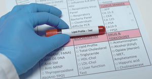The REAL Truth About Cholesterol and Avoiding Heart Disease