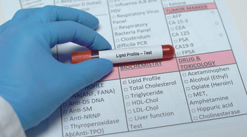 The REAL Truth About Cholesterol and Avoiding Heart Disease