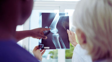 This bone disease kills more women than breast cancer